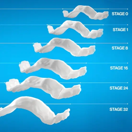 Several stages of Invisalign aligners.